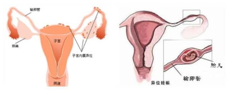 上海助孕代怀生子